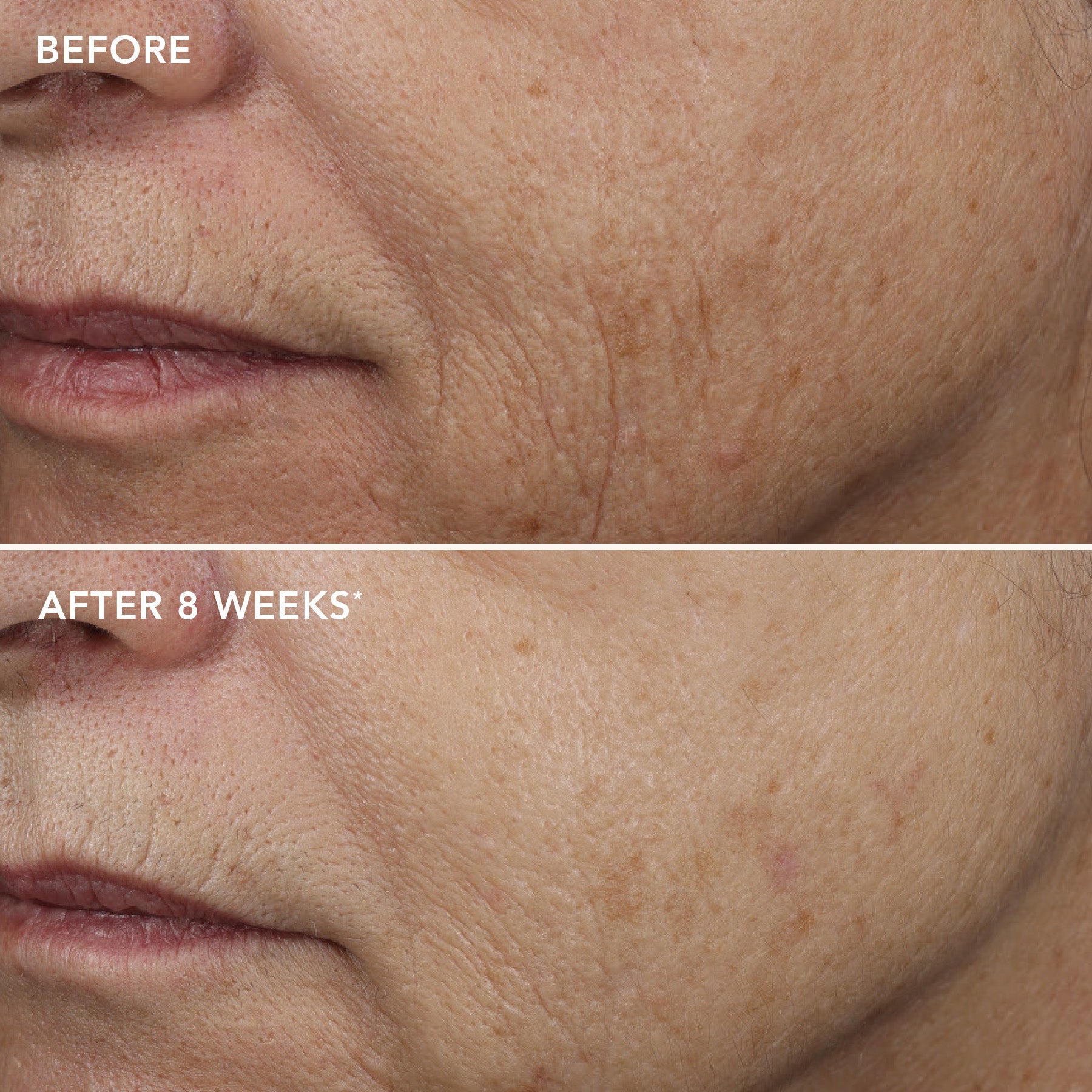 Before and after images of face after 8 weeks of use