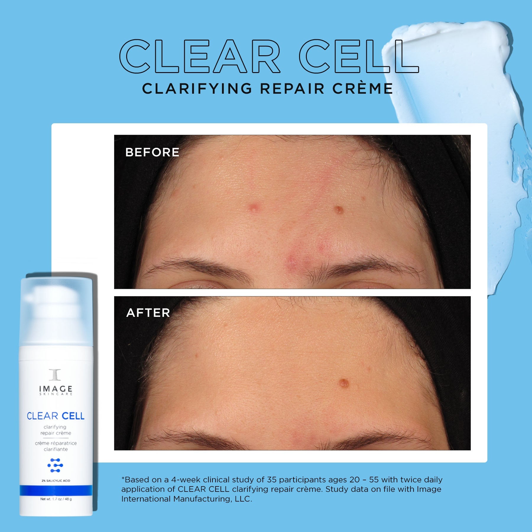CLEAR CELL clarifying repair crème before and after images showing results after 4 weeks