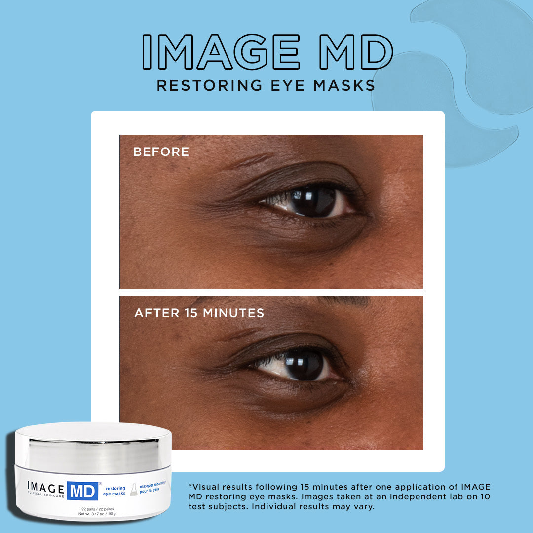 Before and after comparison of a woman using the restoring eye masks for 15 minutes