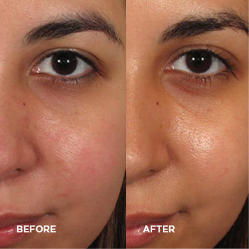 dark spots